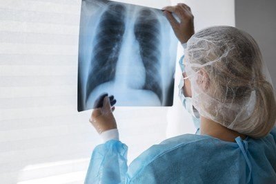 turber Foto: Freepik RENAN ALEXANDRINI Da Redação* A semana é marcada por uma série de ações dos municípios do ABC contra a tuberculose. Causada por uma bactéria que atinge principalmente os pulmões, a doença contamina 70 mil pessoas no Brasil e gera, em média, 4,5 mil mortes todos os anos. Foi pensando nisso que, em 2017, o Ministério da Saúde criou o plano nacional Brasil Livre da Tuberculose, cujo objetivo é, até 2035, reduzir 90% o